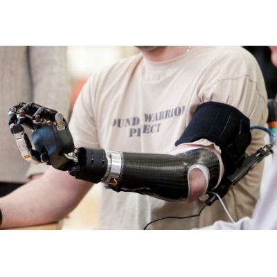 Daily Rehabilitation Training Method of Upper Limb Prosthetics (Hand Prosthetics)